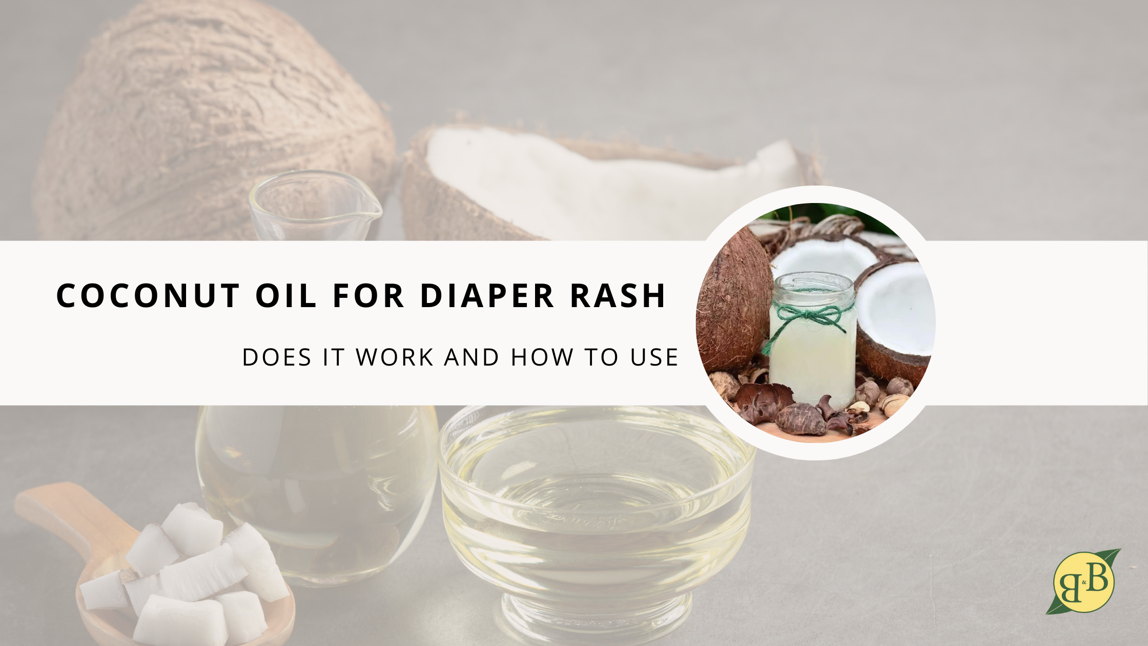 Coconut Oil dandruff and dry, Itchy scalp - Best for Diaper Rash